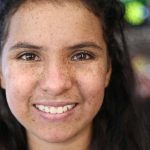 Xeroderma Pigmentosum, Gangguan Genetik Sensitif Matahari