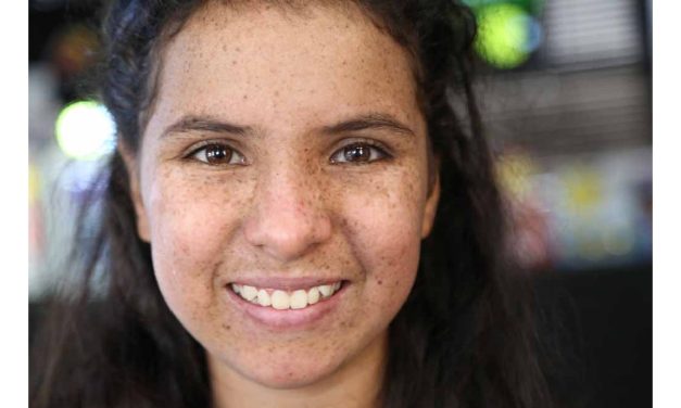 Xeroderma Pigmentosum, Gangguan Genetik Sensitif Matahari