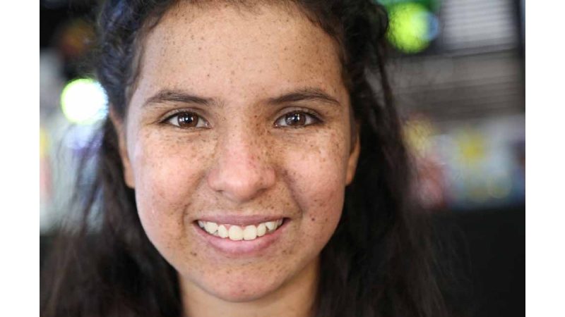 Xeroderma Pigmentosum